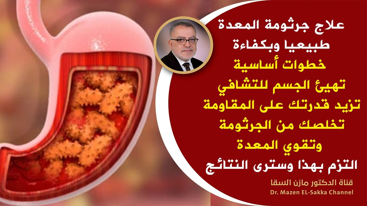 علاج جرثومة المعدة الفعال من الطبيعة نصائح هامة للتخلص منها في مدة وجيزة | علاج جرثومة المعدة طبيعيا