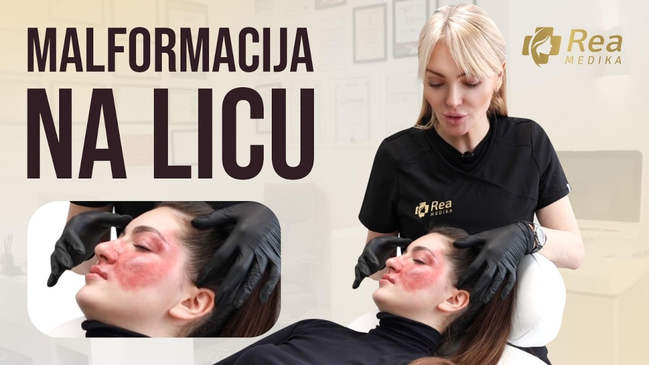 Estetska medicina rešava anomalije na licu - evo i kako | REAlity epizoda 1