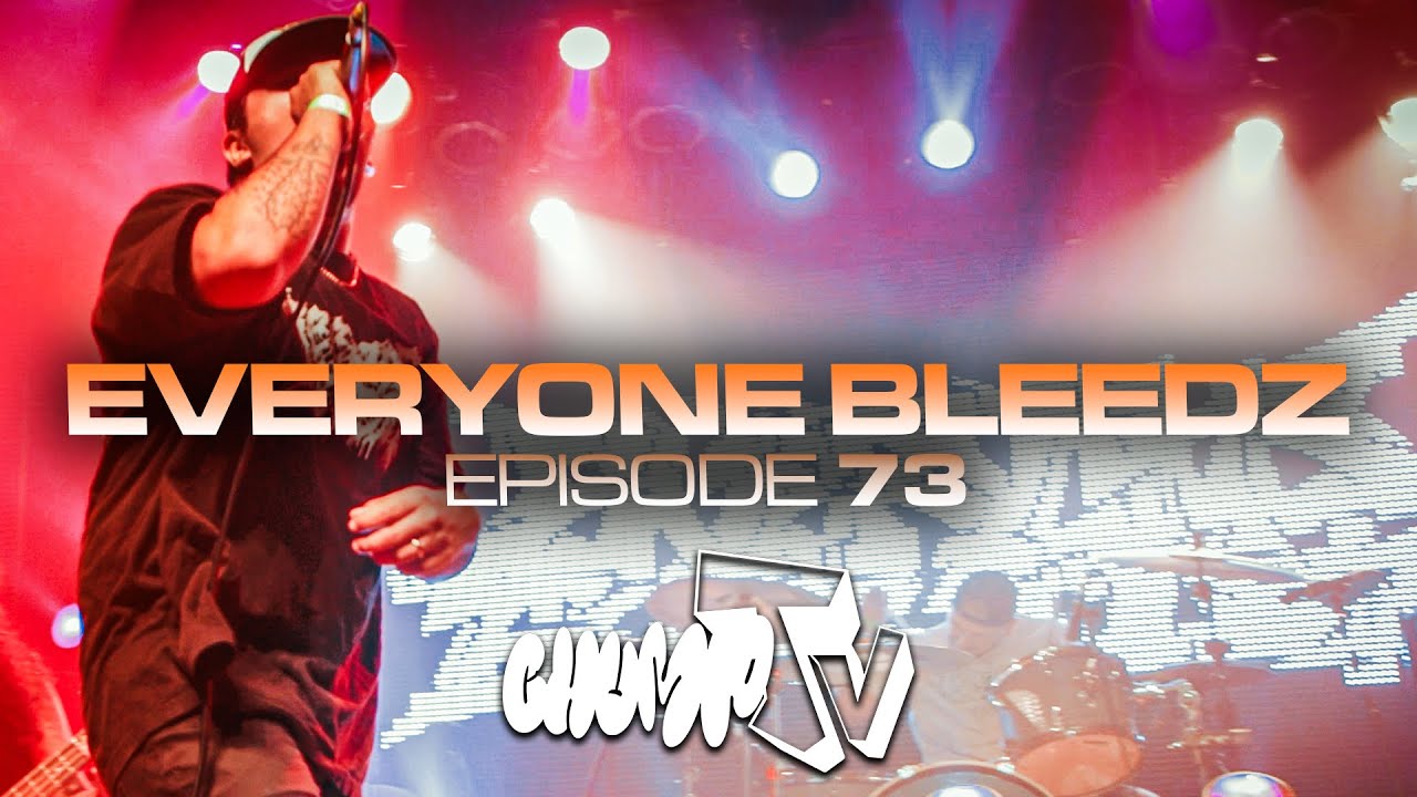 CHUMPTV : EP73 - EVERYONE BLEEDZ