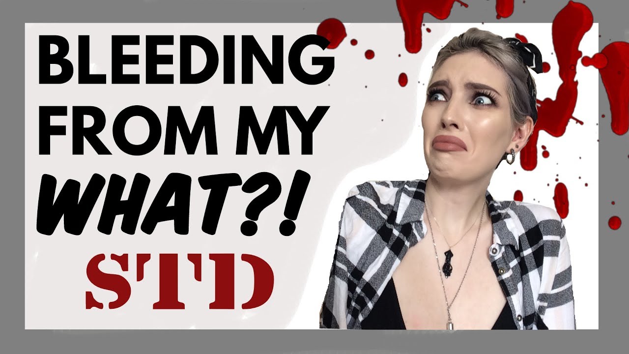 The WORST STDs you can get [CC]