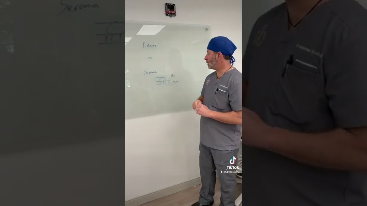 Edema vs Seroma