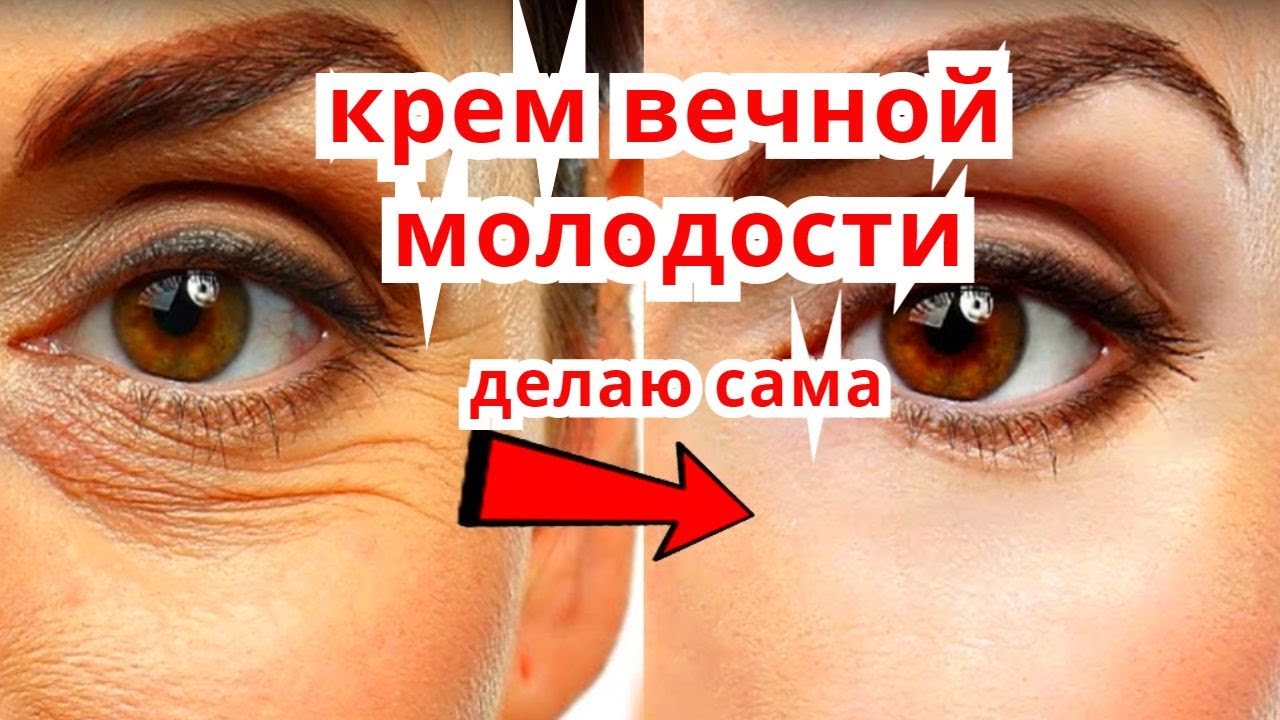 Морщины Вокруг Глаз уйдут СРАЗУ ! Омолаживающий Крем Делаю Сама . Рецепт