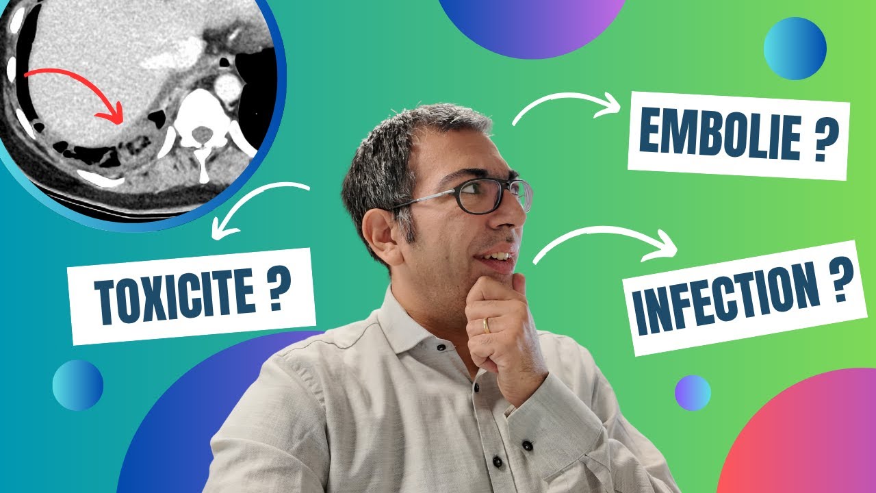Un cancer pulmonaire métastatique qui répond spectaculairement à l'immunothérapie... Sauf que...