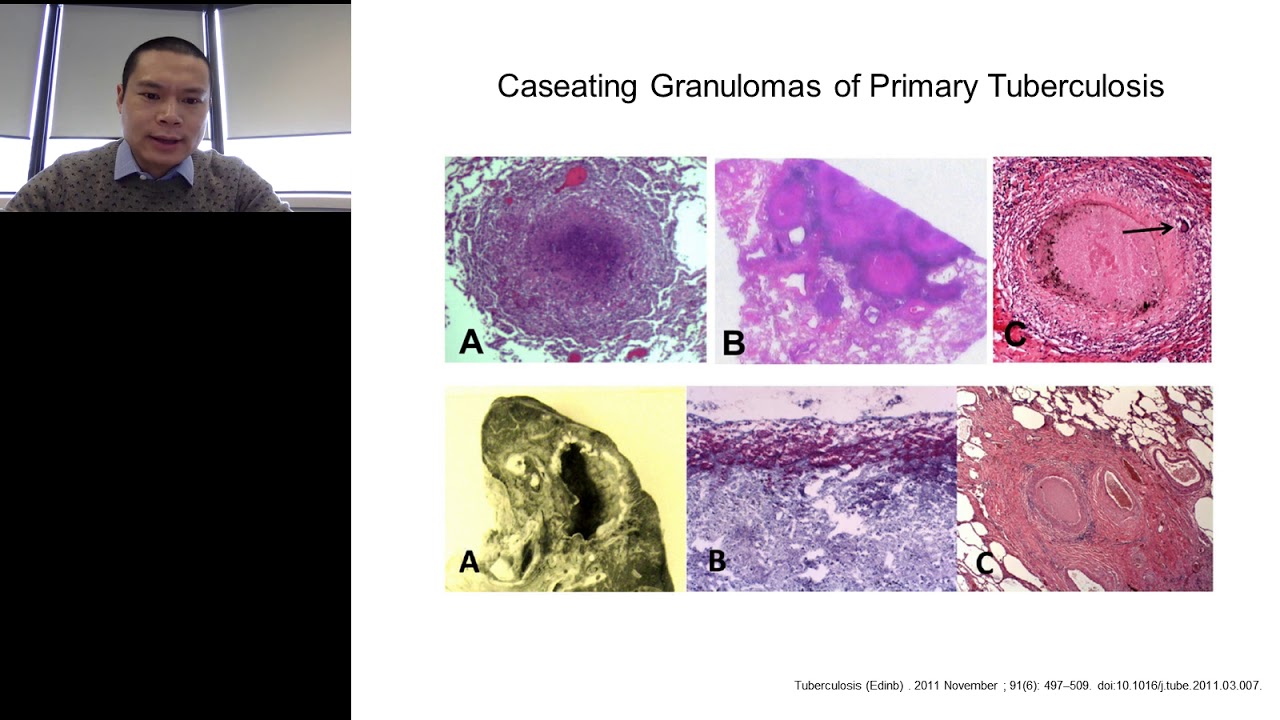 Animal Models for Tuberculosis Research