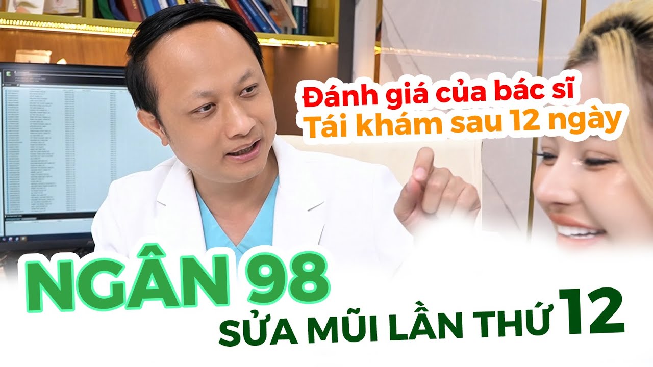 Bác Sĩ Huy Phân Tích  Sửa Mũi Lần Thứ 12 Ngân 98 Sau 10 Ngày