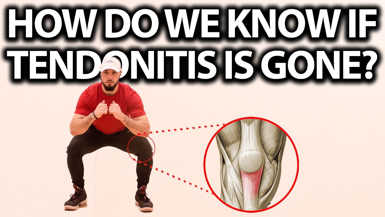 How To Know If Your Patellar Tendonitis Is Gone (When Can You Return to Your Sport?)