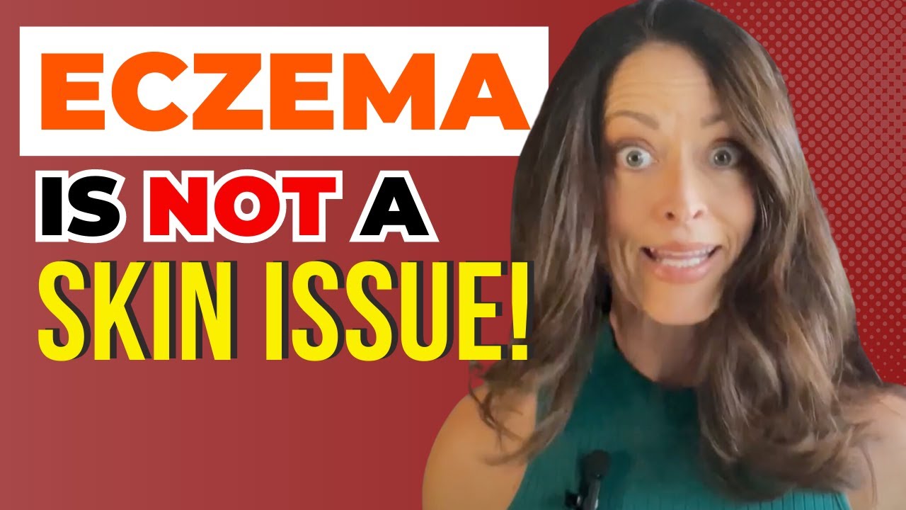 Eczema and the Gut | Getting to the Root Causes