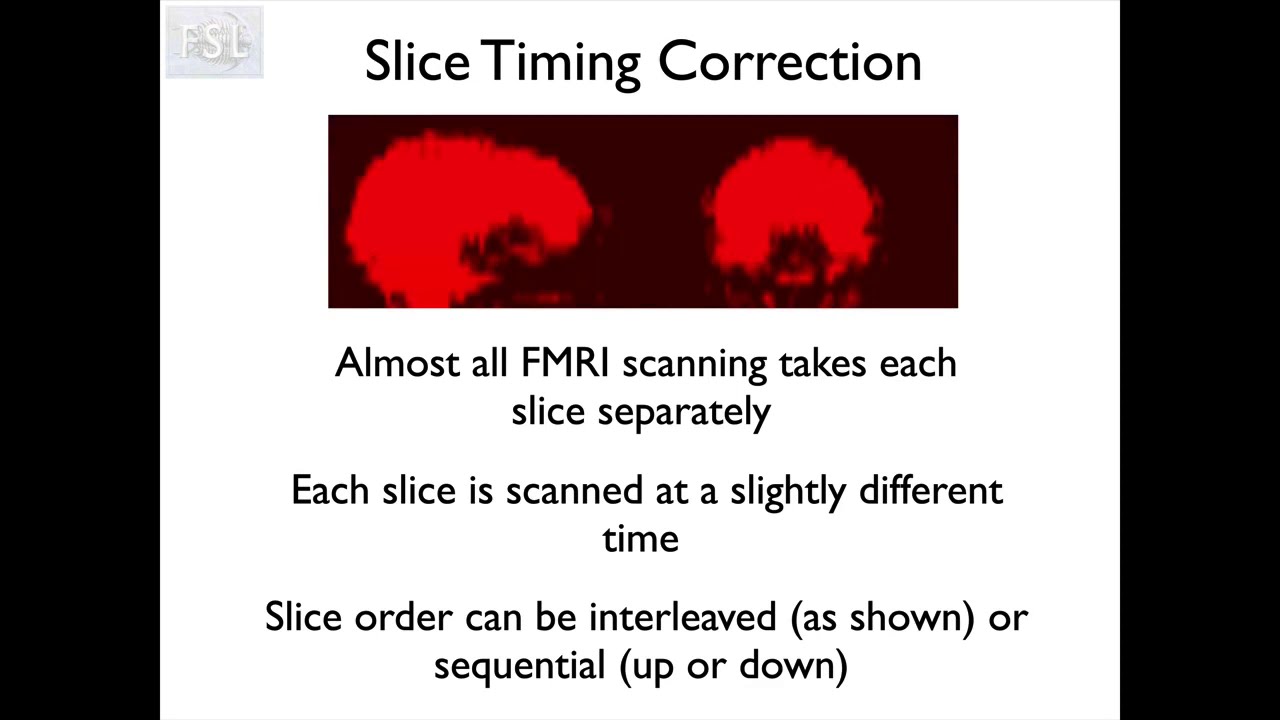 12. FMRI1: Preprocessing (Fmri1 E2)