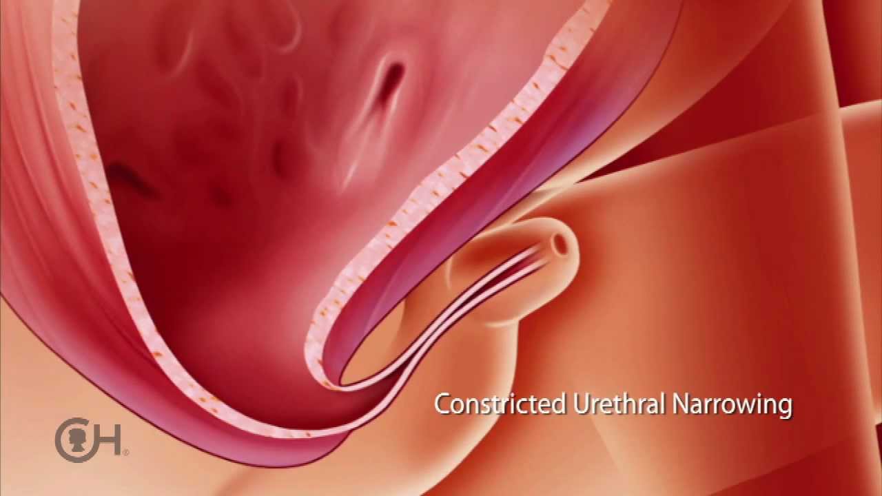 Causes and Consequences of LUTO (2 of 9)