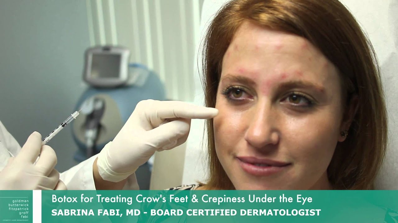 Botox for Crow's Feet | Botox Around Eyes | Dr. Fabi