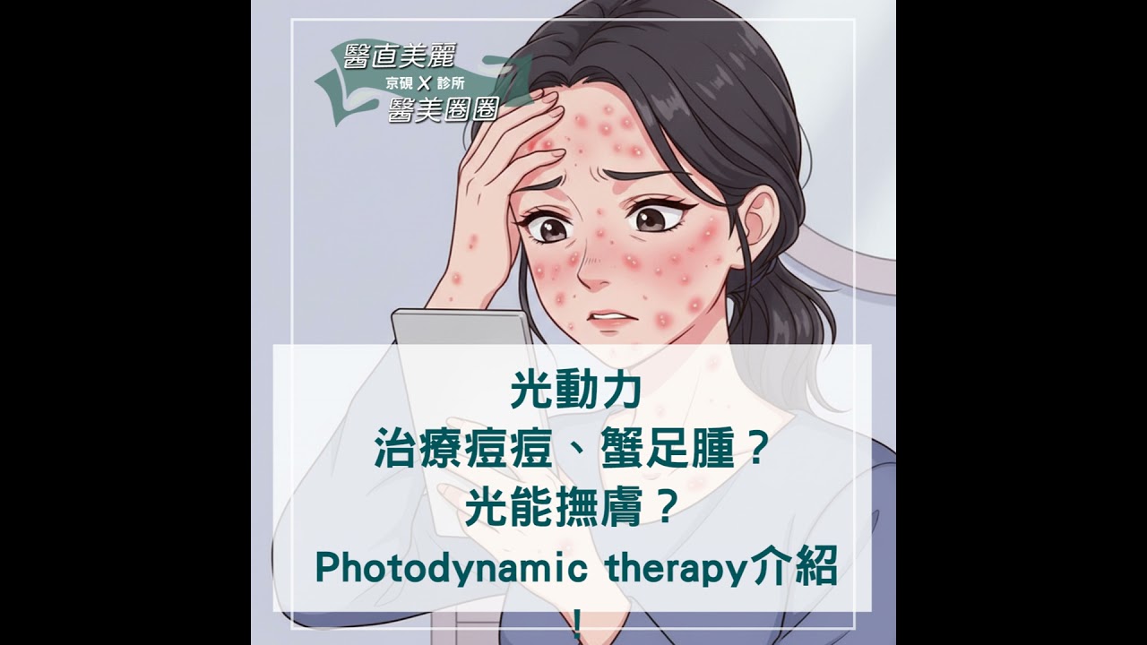 【S2 EP.087】光動力(PDT) 治療痘痘、蟹足腫？光能撫膚？ Photodynamic therapy介紹
