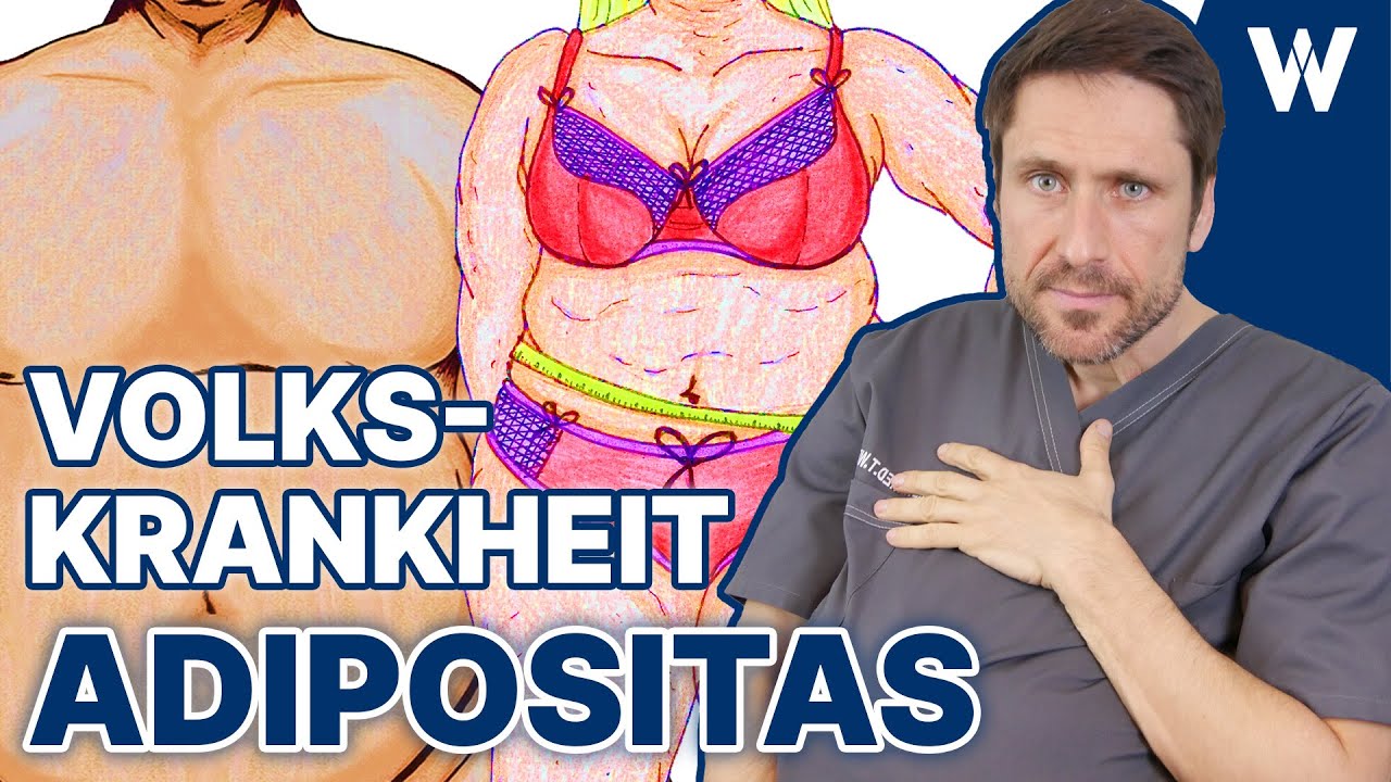 Body Positivity? Lasst uns mal Tacheles über Übergewicht reden: Über 50% von uns sind übergewichtig!