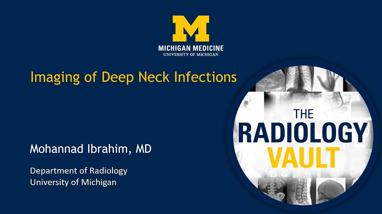 MRI & CT of Deep Neck Infection
