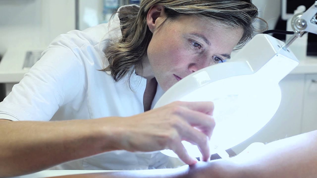 Informatiefilm over de behandeling van spataderen