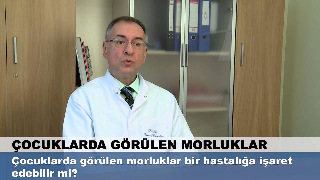 Çocuklarda görülen morluklar bir hastalığa işaret edebilir mi?
