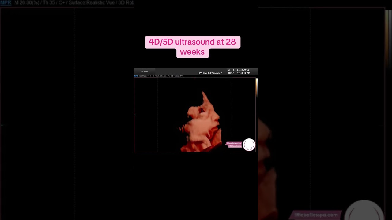 Seeing baby girl in 4D/5D ultrasound at 28 weeks 