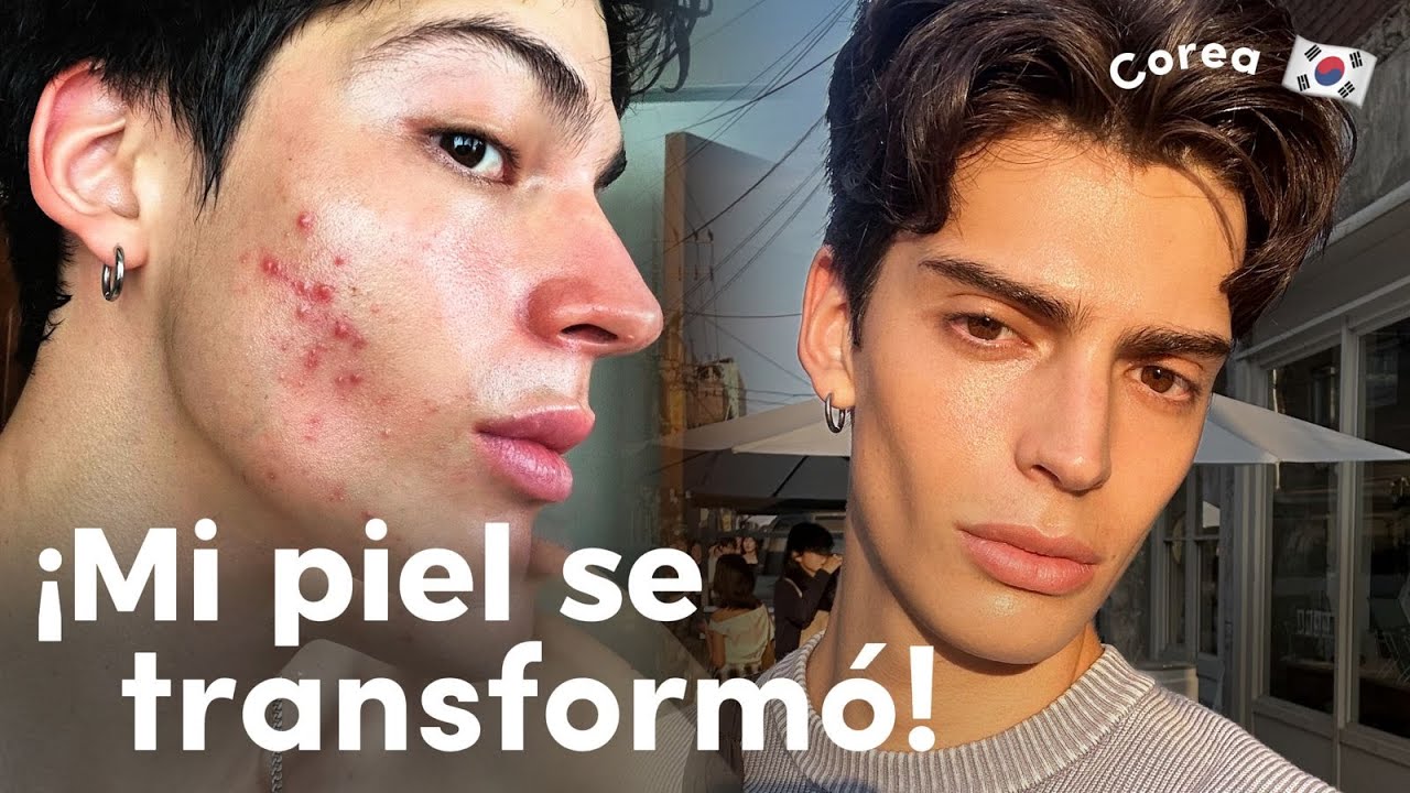 &iexcl;Secretos coreanos para una piel PERFECTA! / Rutina de SkinCare, cl&iacute;nica dermatol&oacute;gica, y M&Aacute;S