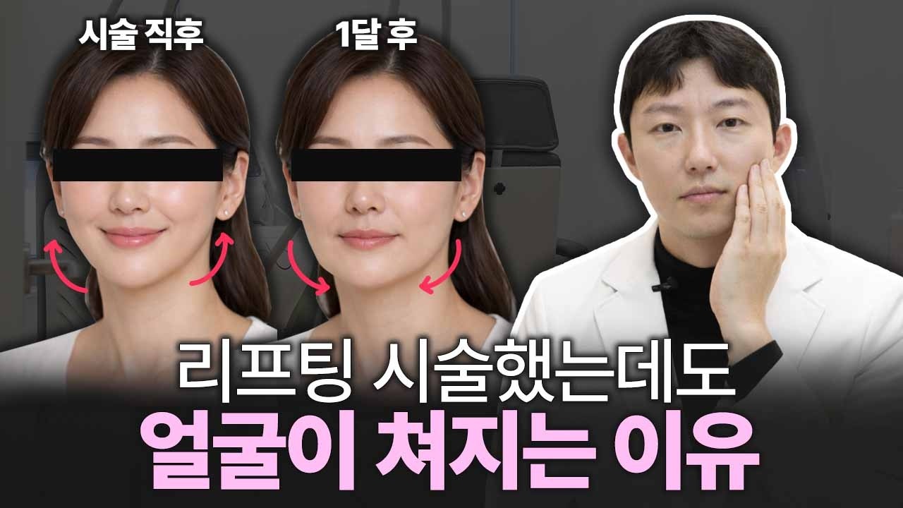 리프팅 시술 후 얼굴이 처지는 진짜 이유와 해결법