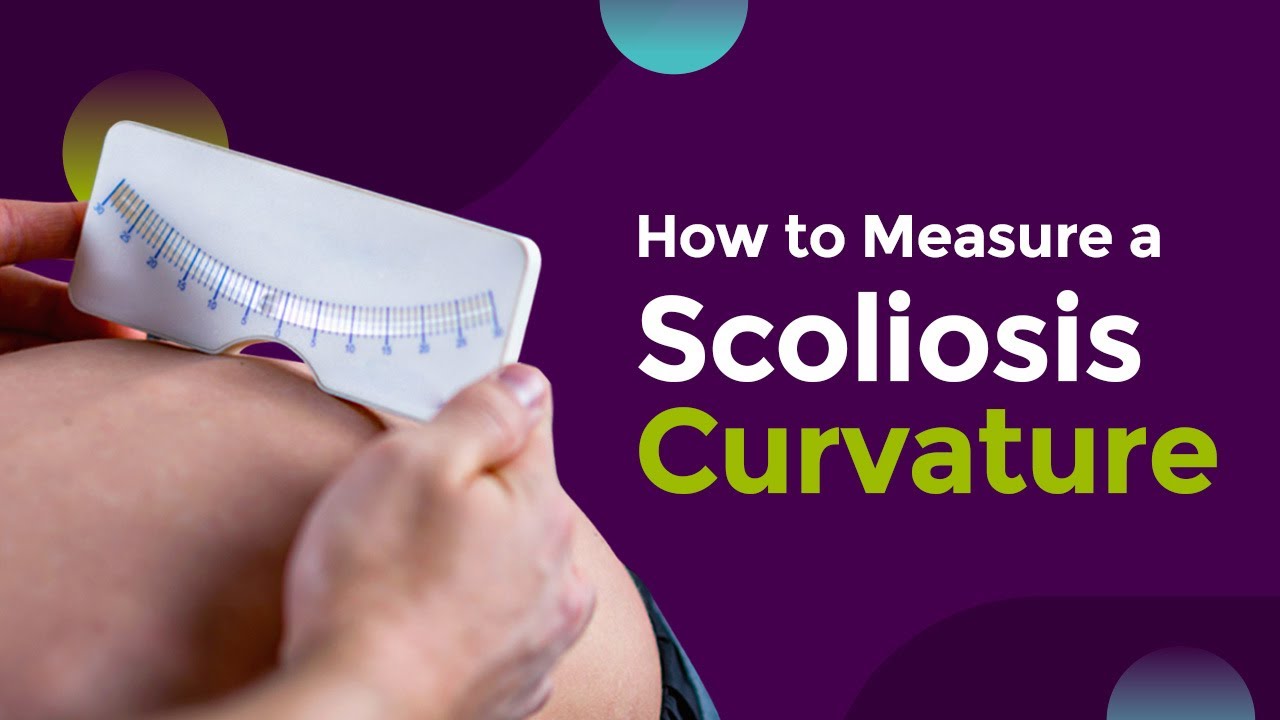 How to Measure a Scoliosis Curvature