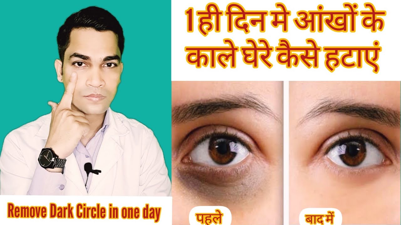 Get rid of Puffy and Saggy Eyes - 5 Minutes Perfect Yoga for Eye Bags | Get rid of droopy Eye Lids