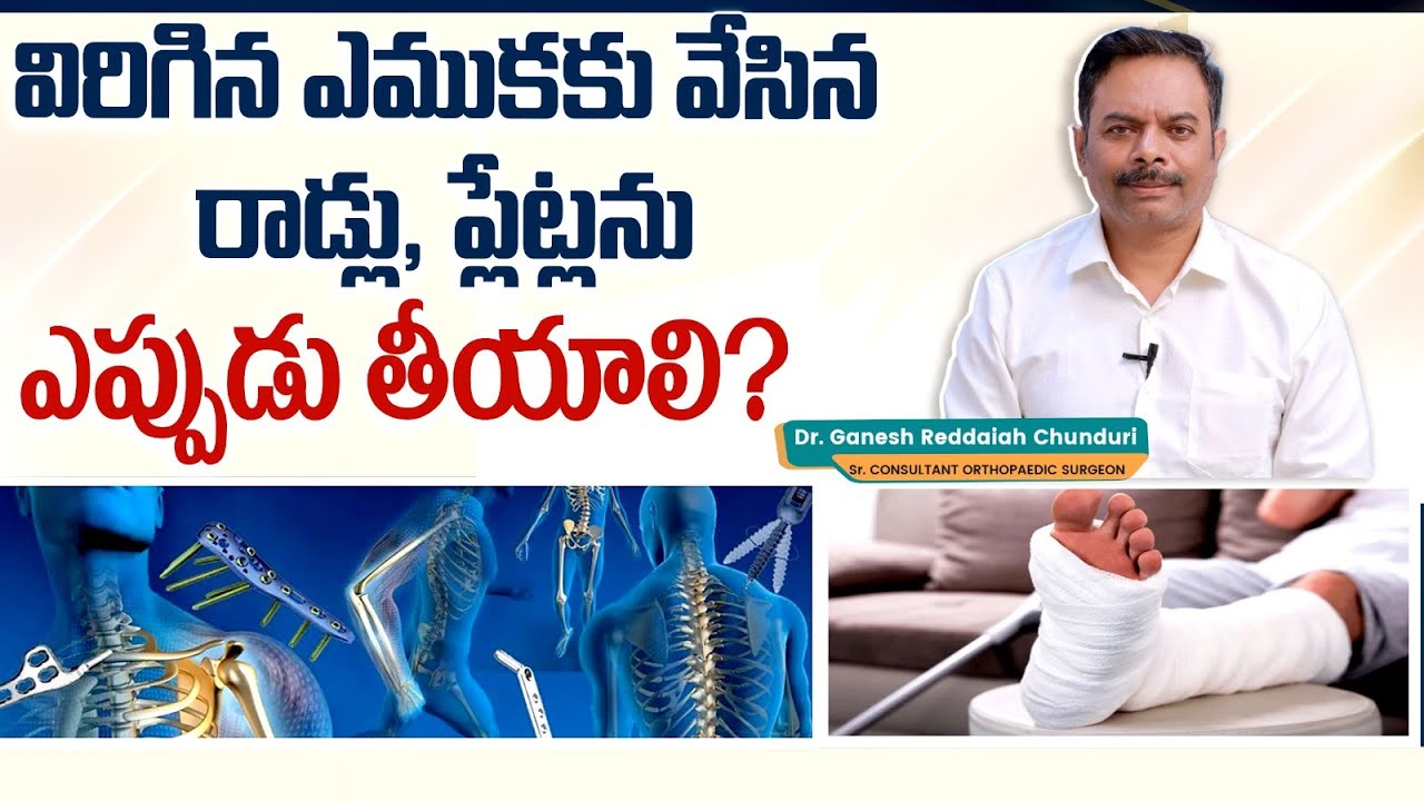 ఒంట్లో రాడ్లు ఎప్పుడు తీయాలి? | Removal of Implants After Orthopedic Surgery | Raghavendra Hospitals