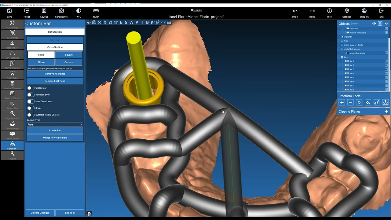 Upper Surgical Guide - RealGuide