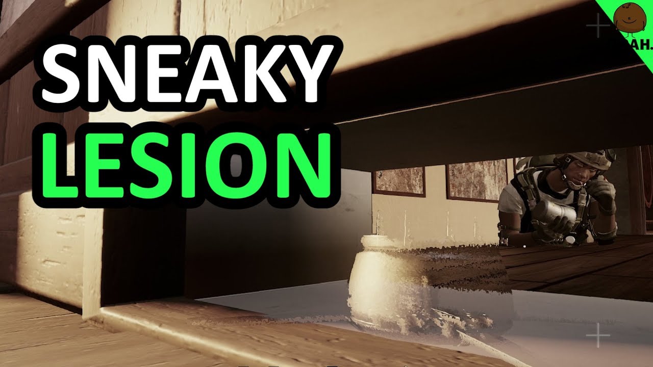 The YOLO Lesion Trick - Rainbow Six Siege
