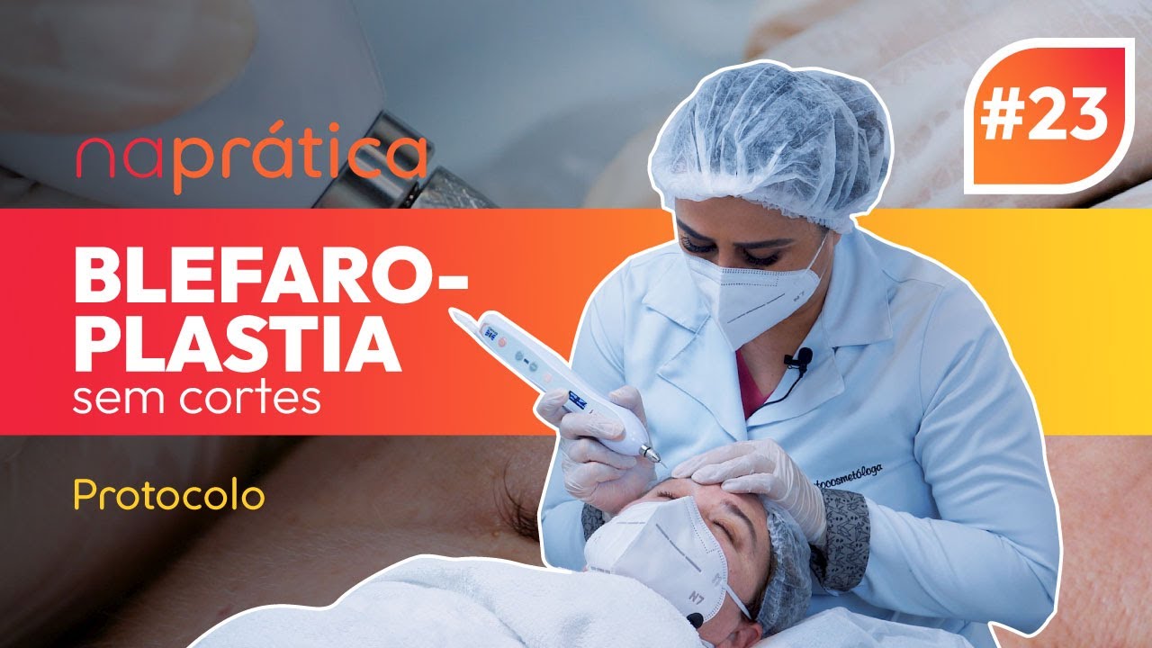 naprática #23 | Como fazer blefaroplastia sem cortes, com jato de plasma | rentalmed