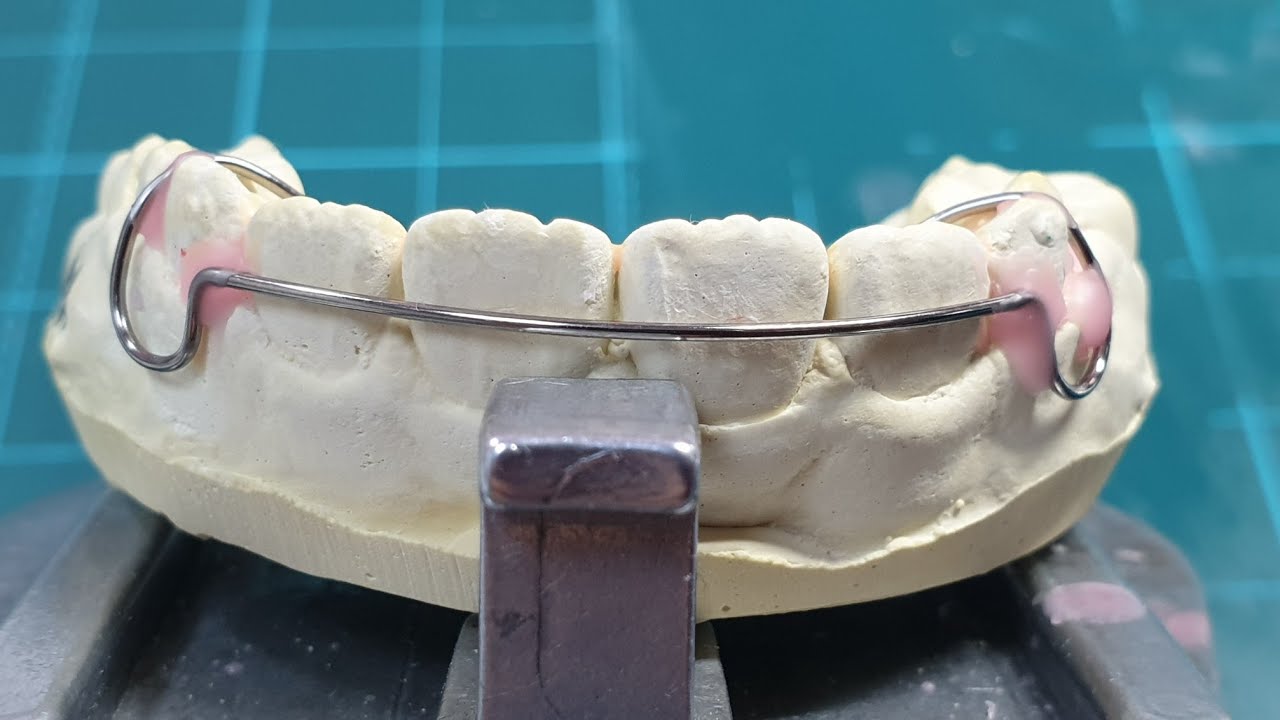labial bow wire bending /retainer labial #retainer