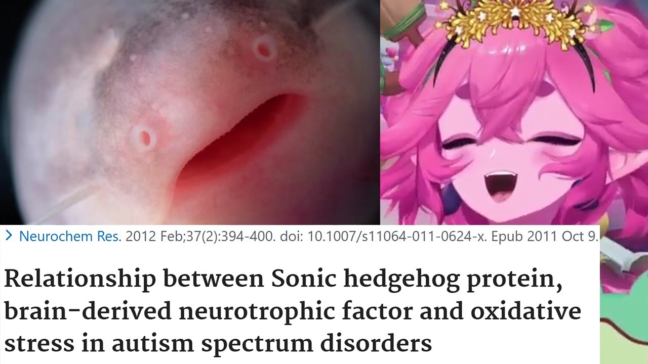Froggy Talks About Bugs, Urethra, and Sonic`