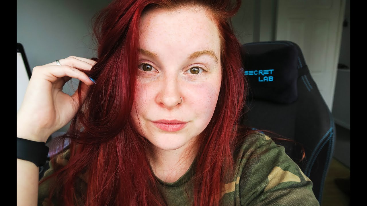 Where's My Blepharitis at Now?