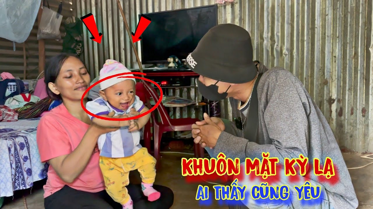 THẰNG BÉ có khuôn mặt KỲ LẠ, ngộ nghĩnh, ai nhìn thấy cũng XÓT THƯƠNG - tập 861