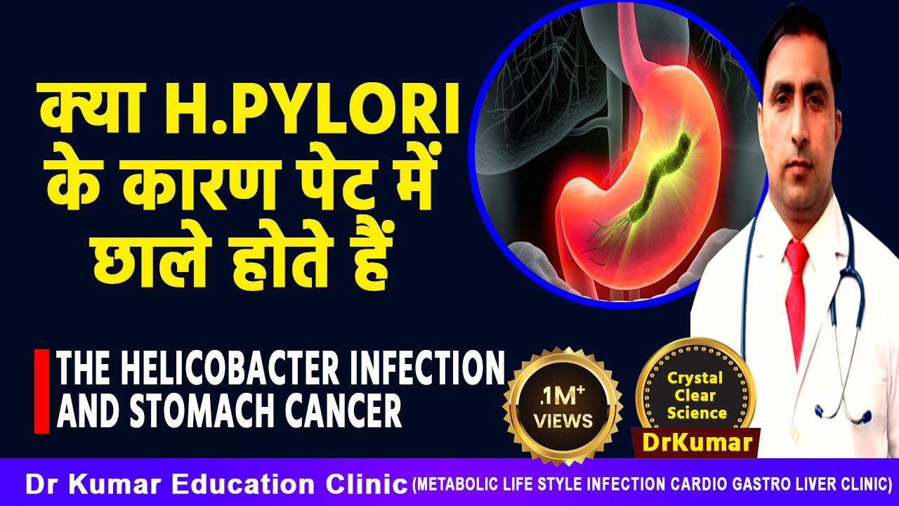 HELICOBACTER PYLORI( H - PYLORI ) // ERADICATION TREATMENT // Dr kumar education clinic