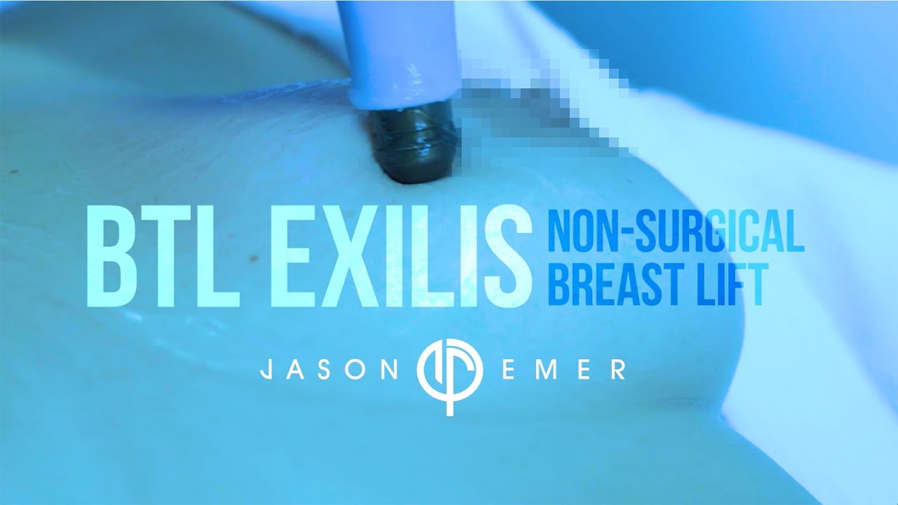 Non-Surgical Breast Lift |  Laser Breast Lift | BTL Exilis | Radiofrequency Skin Tightening