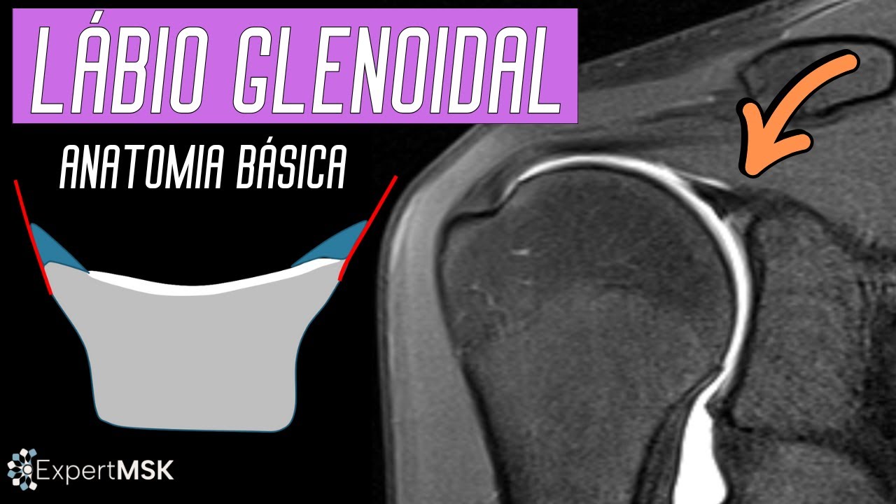 LÁBIO GLENOIDAL - Anatomia Básica
