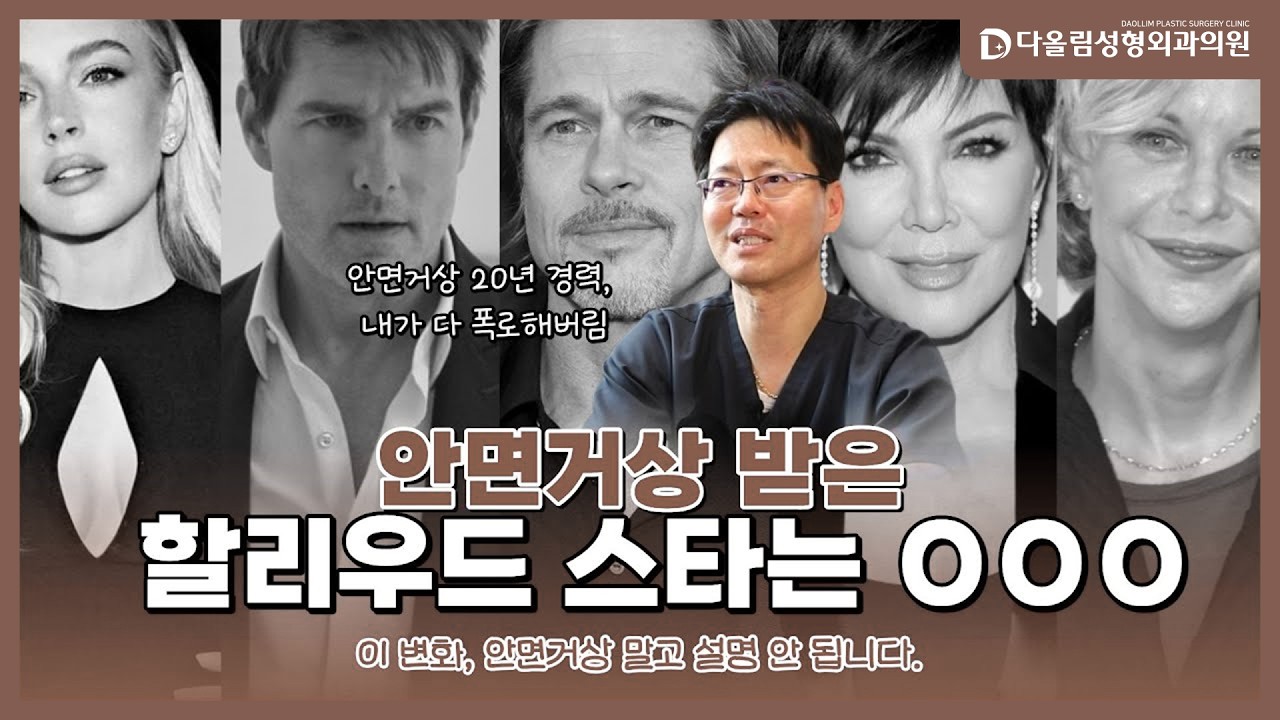 헐리우드 성형의 실체! 안면거상 성형외과 전문의 폭로!
