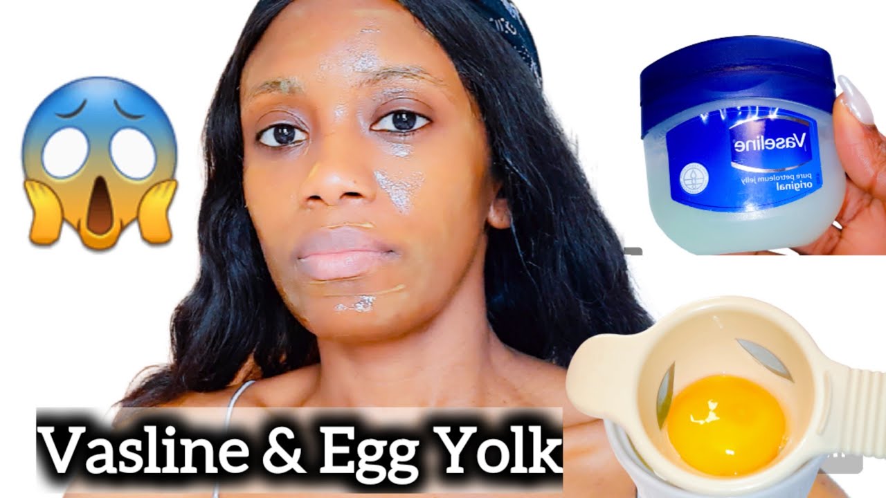 You Won't Believe What Vasline And Egg Yolk Did To My Skin, Ideal For Dry Dehydrated Skin.