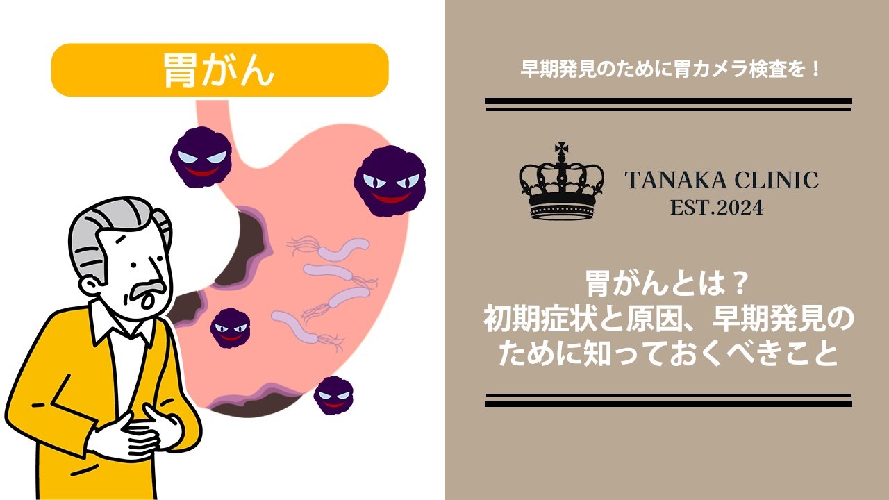 13　胃がんとは？初期症状と原因、早期発見のために知っておくべきこと｜【胃腸と内視鏡の専門チャンネル】たなか内科クリニック