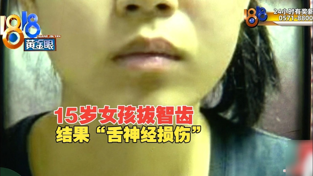 【1818黄金眼】姑娘拔智齿引发舌神经损伤，“事故”还是“并发症”？
