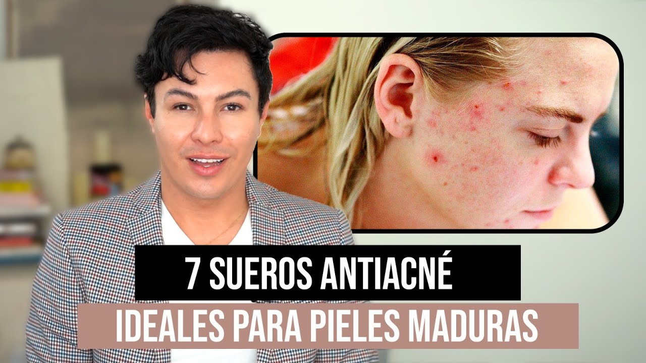 7 sueros anti acné perfectos para las pieles adultas