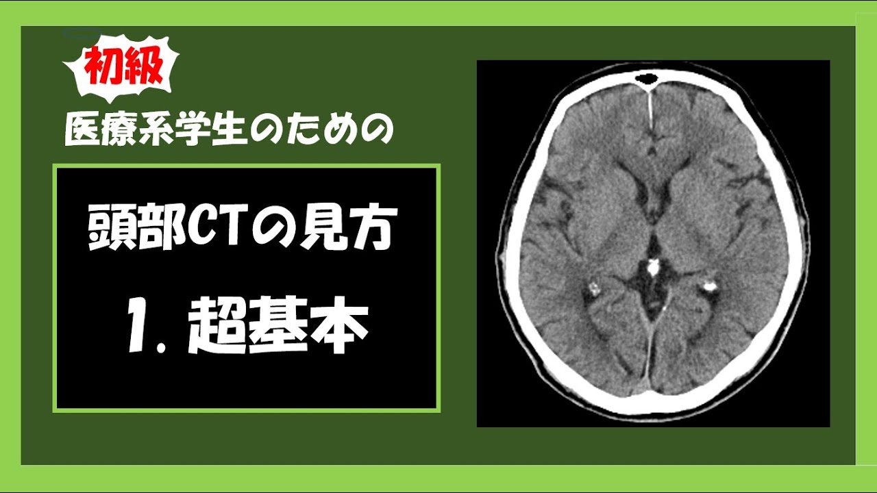 【医療系学生】初心者向き頭部CT 1. 超基本