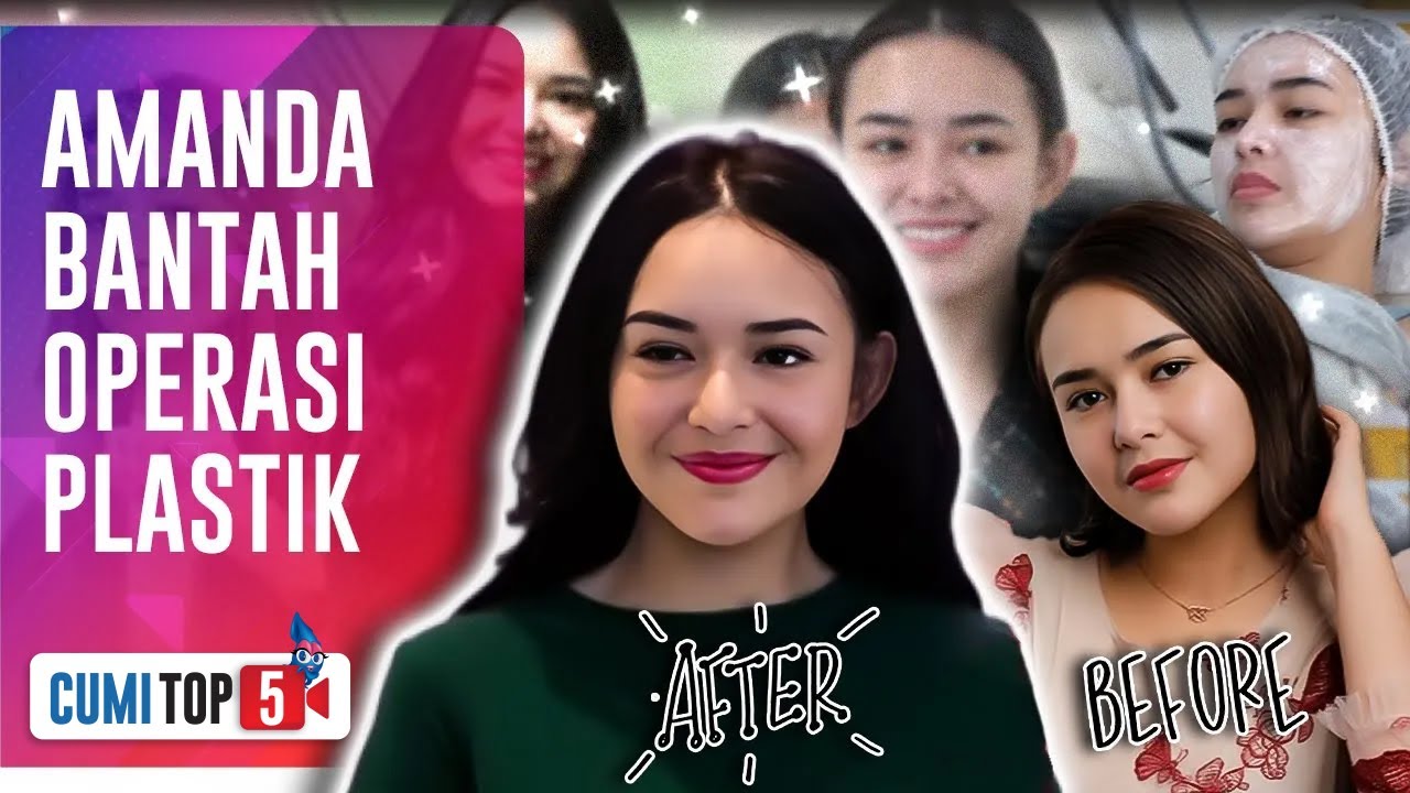5 Rahasia Perubahan Drastis Wajah & Lekuk Tubuh Amanda Manopo : Anti Operasi Plastik! | CUMI TOP V