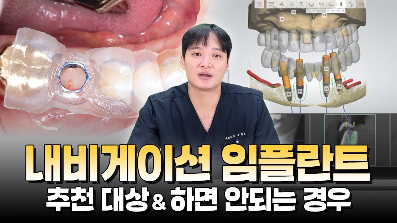 대전치과·대전임플란트ㅣ내비게이션 임플란트, 가능한 경우 vs 어려운 경우
