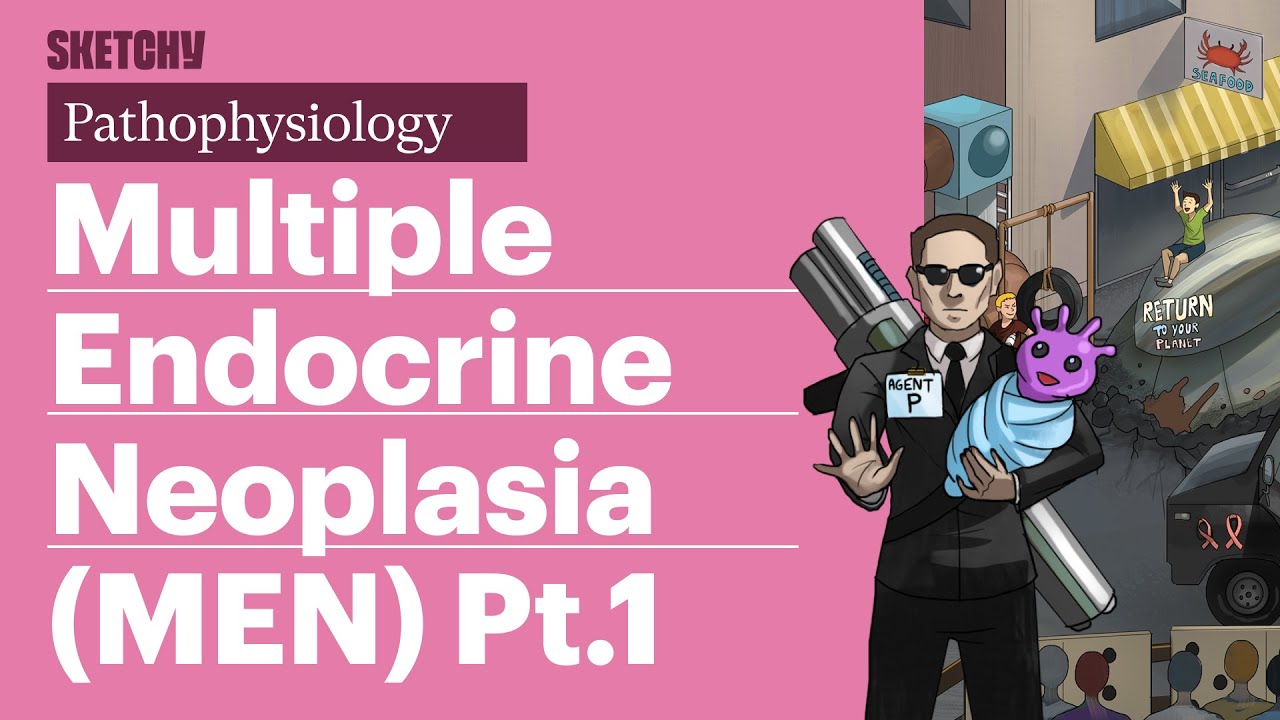 Multiple Endocrine Neoplasia (MEN): Full Lesson (Part 1) | Sketchy Medical  | USMLE Step 1