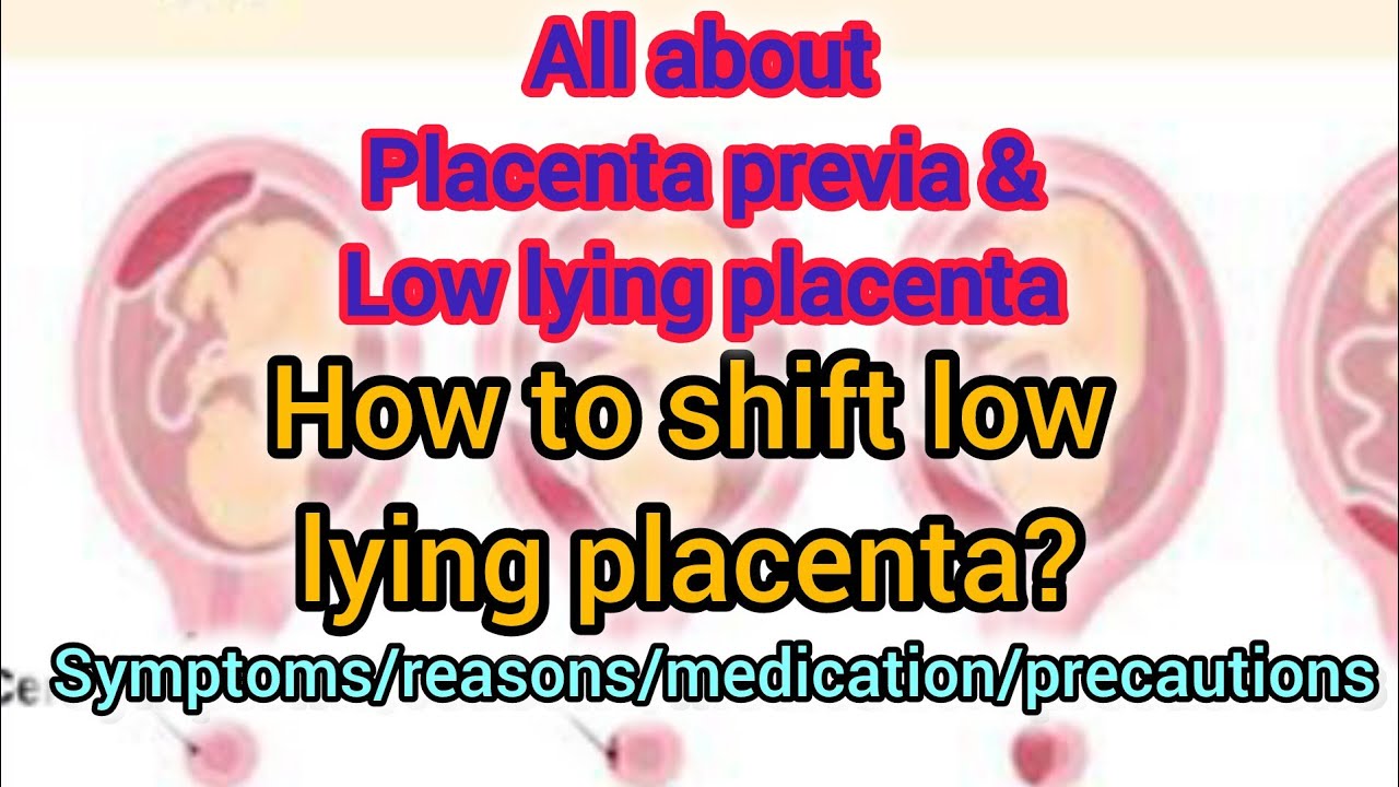 Low lying placenta/plecenta previa ಇದ್ರೆ ಎನಾಗತ್ತೇ?ಹೇಗೆ ಸರಿ ಮಾಡೋದು?#pregnancy #pregnant #baby#kannada