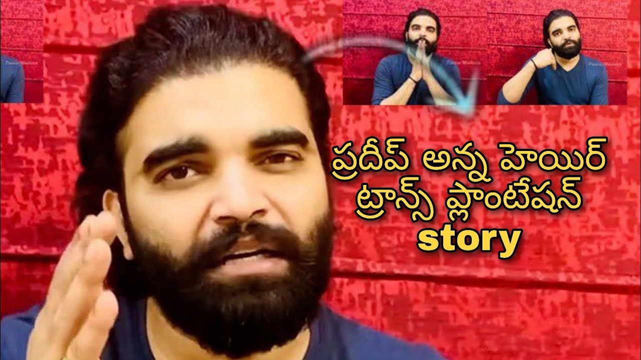 pradeep anna hair transplantation story నిజంగా pradeep anna  హెయిర్ ట్రాన్స్ ప్లాంటేషన్ చేపించాడా?