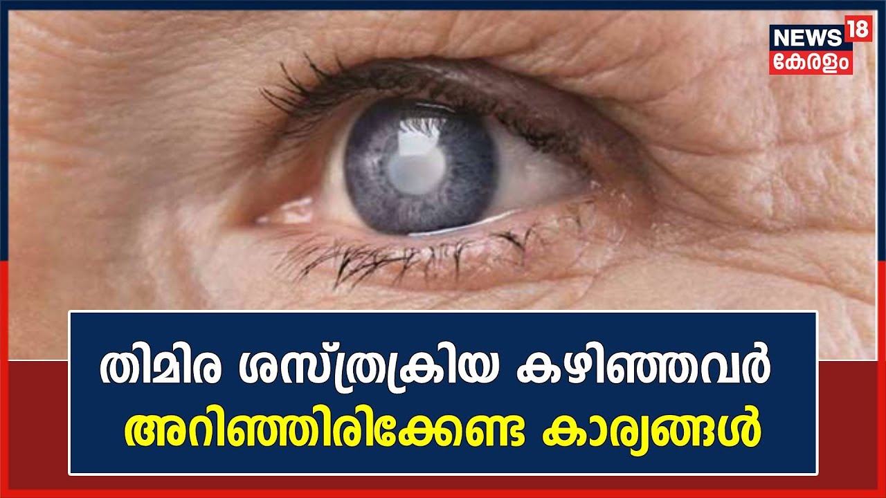 Dr Q | തിമിര ശസ്ത്രക്രിയ കഴിഞ്ഞവർ അറിഞ്ഞിരിക്കേണ്ട കാര്യങ്ങൾ | Malayalam Health Show