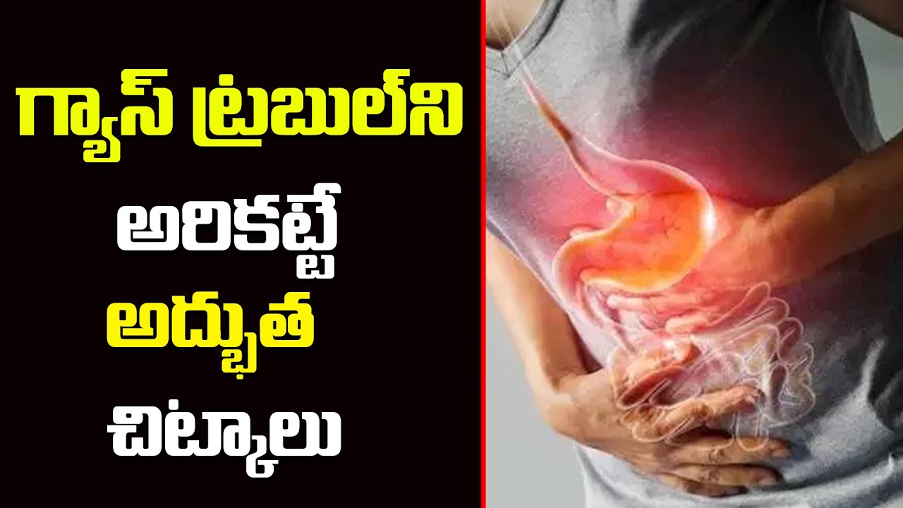 Home Remedies For Get Rid of Gas Trouble | Gastric Problem | Mana Arogyam