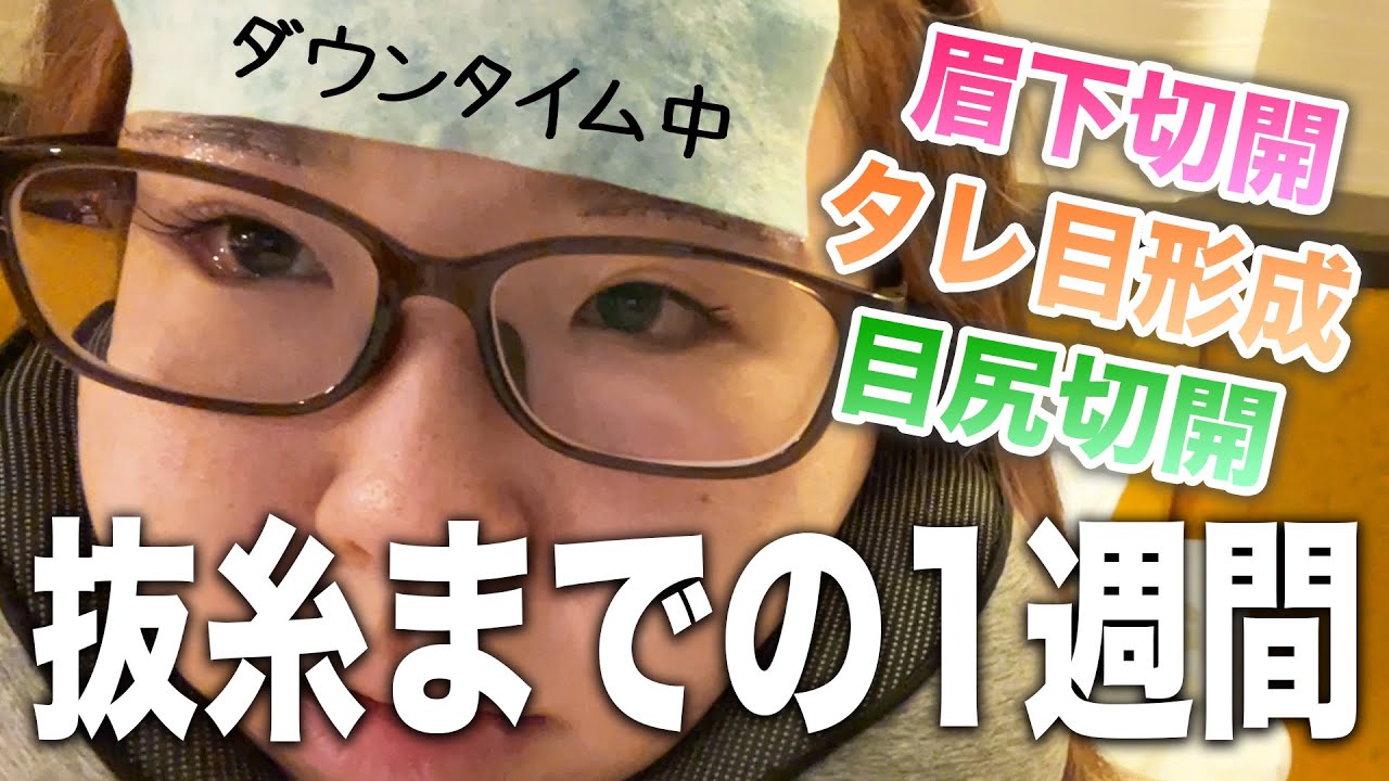 【整形後1週間レポ】眉下切開・目尻切開・タレ目形成やりましたーん【ダウンタイム】