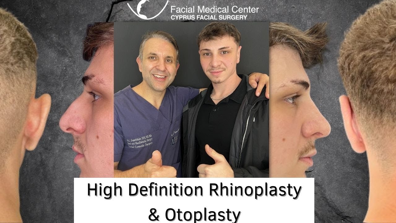 High Definition Rhinoplasty & Otoplasty |Cyprus Facial Surgery